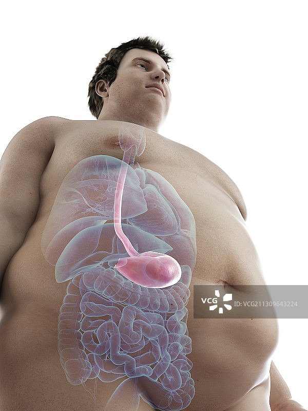 一个肥胖男子的胃的插图图片素材
