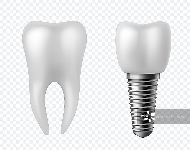 牙齿和植牙手术人类白图片素材