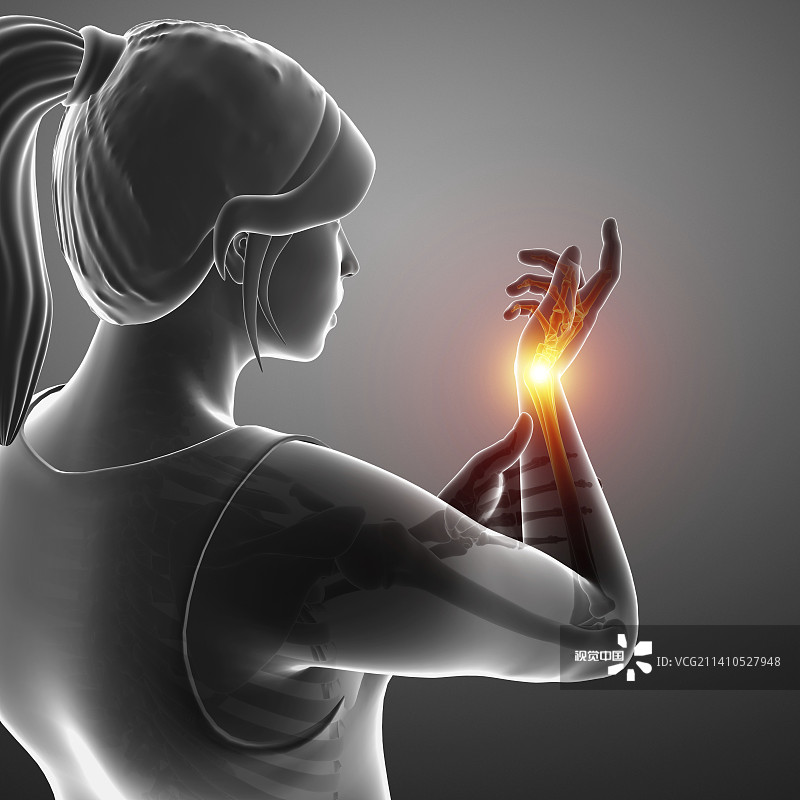 手腕疼痛的妇女，插图图片素材