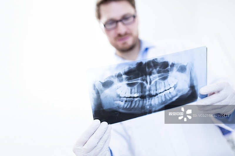 牙医握着x光片图片素材