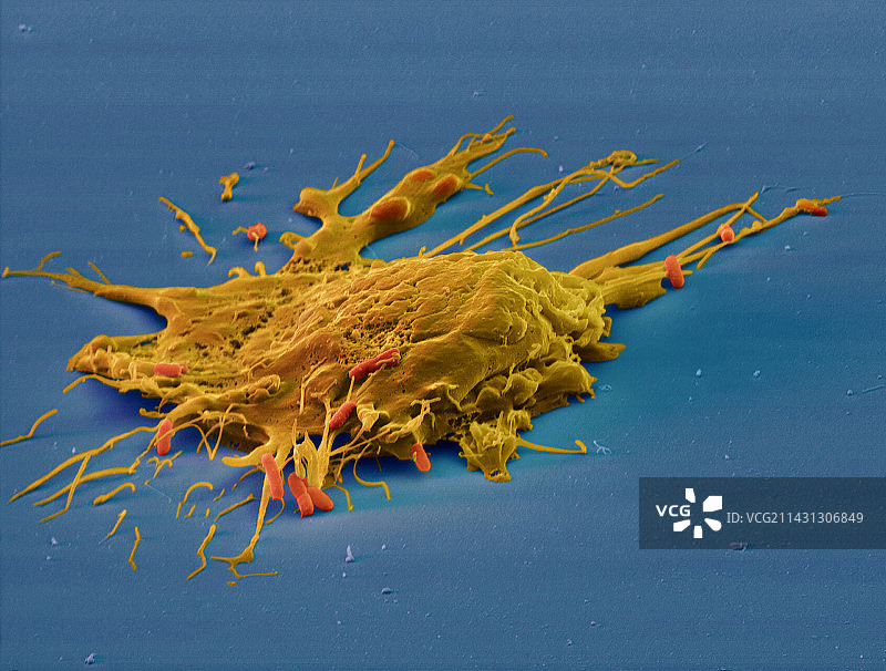 巨噬细胞吃大肠杆菌的彩色扫描电镜图片素材