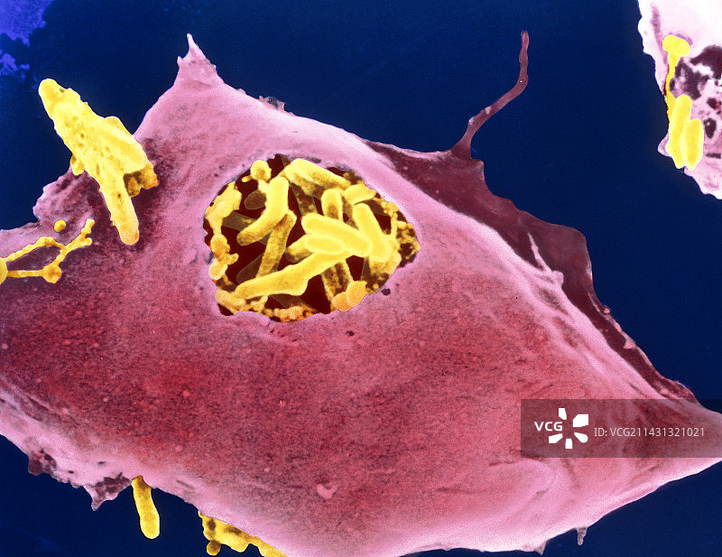 巨噬细胞吃结核细菌图片素材
