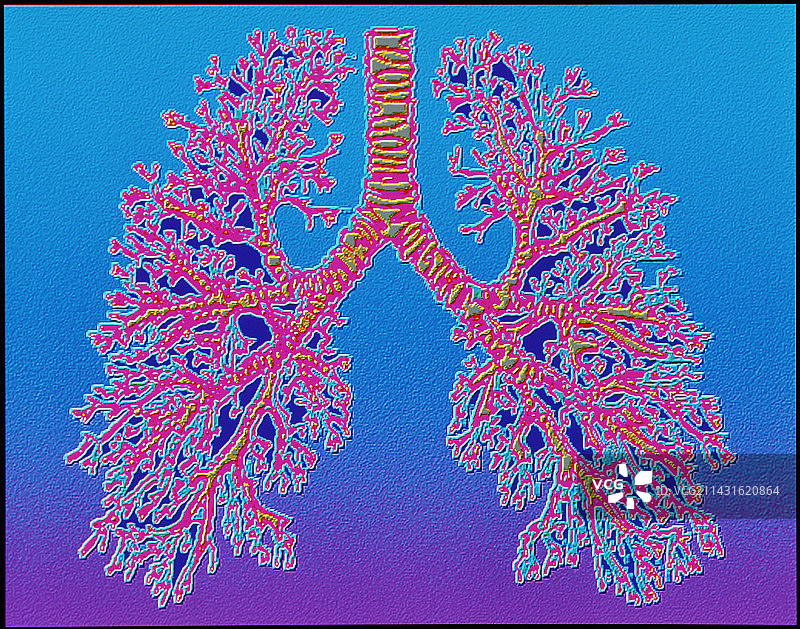 人体肺、气管及细支气管的计算机艺术图片素材