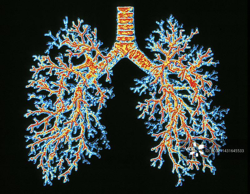 肺气道图片素材