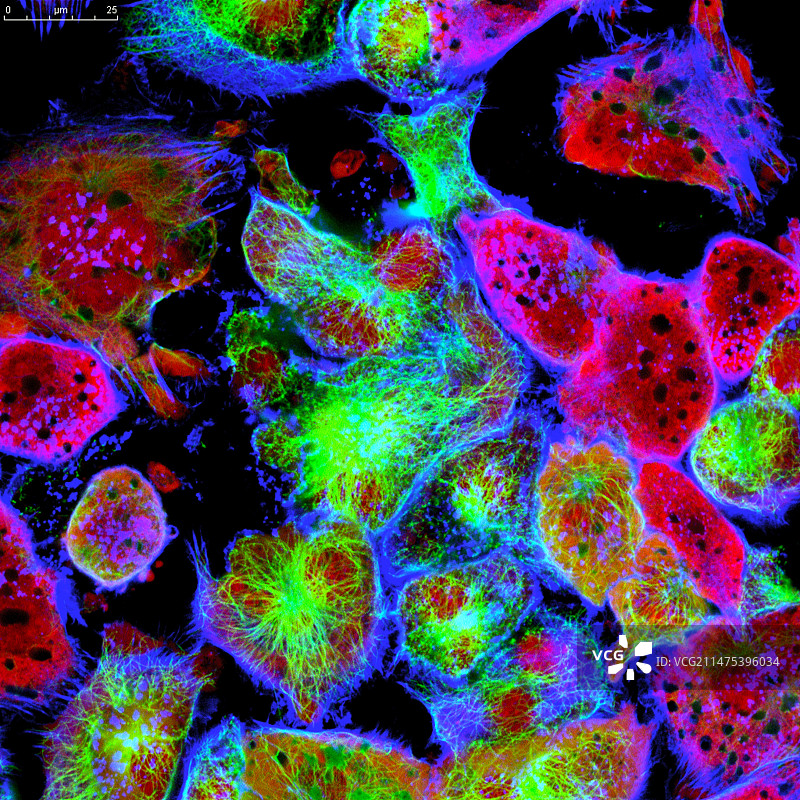 神经母细胞瘤细胞，荧光显微照片图片素材