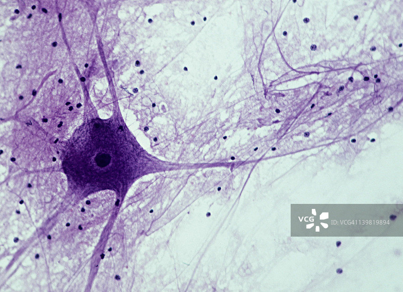 运动神经元;脊髓，50X, 35mm。显示:细胞体、细胞核、树突(附着在细胞体上的多个突起)、轴突(单、长、神经纤维)、神经胶质细胞(黑点)。图片素材