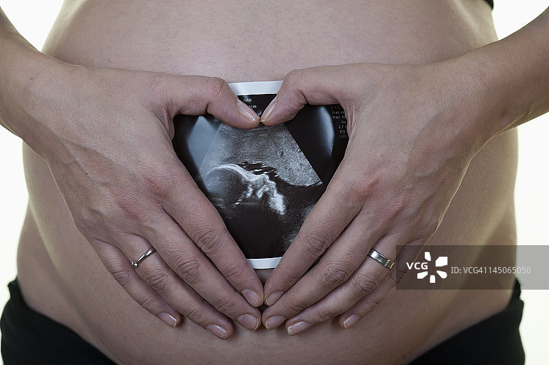 一名孕妇把超声波打印出来贴在肚子上图片素材