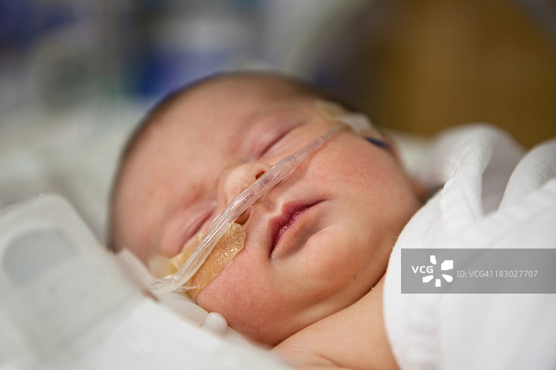 新生儿在光明节接受氧气图片素材