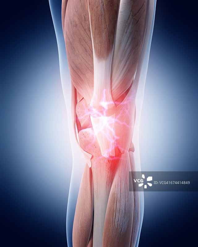 人类的膝盖疼痛图片素材