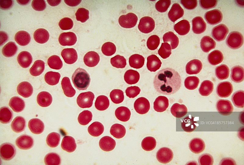红血球和白细胞的光显微镜照片图片素材