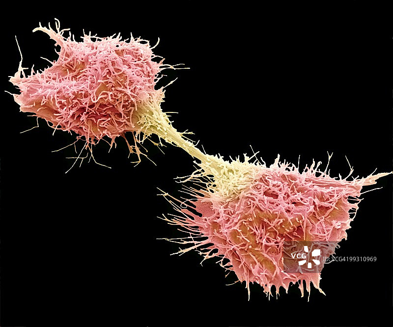 分裂性纤维肉瘤细胞图片素材