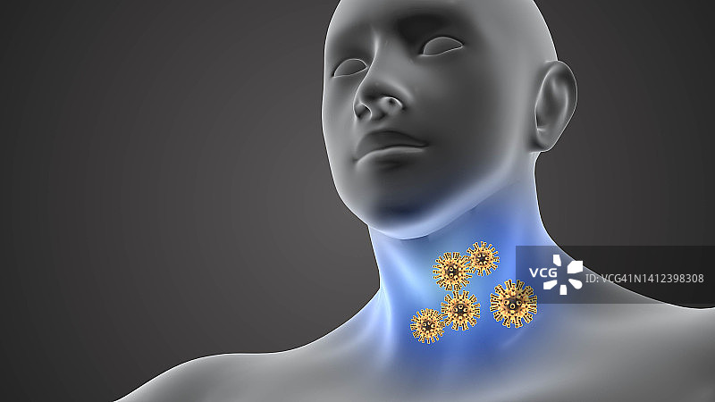 人的喉咙感染了冠状病毒图片素材