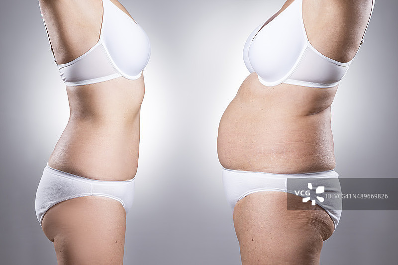 女人减肥前后的身体状况图片素材