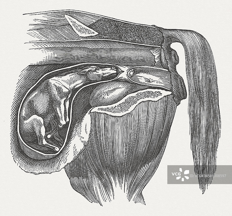 牛胎儿:姿势异常，前腿后弯，出版于1883年图片素材