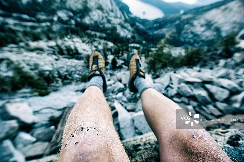 在加州太浩湖爬山时撞到膝盖图片素材
