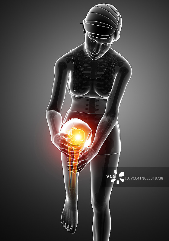 膝关节疼痛图片素材
