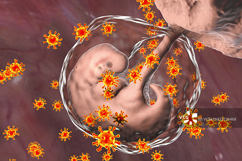 病毒感染人类胚胎，概念说明图片素材