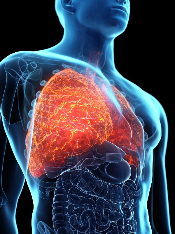 患病的肺，概念说明图片下载