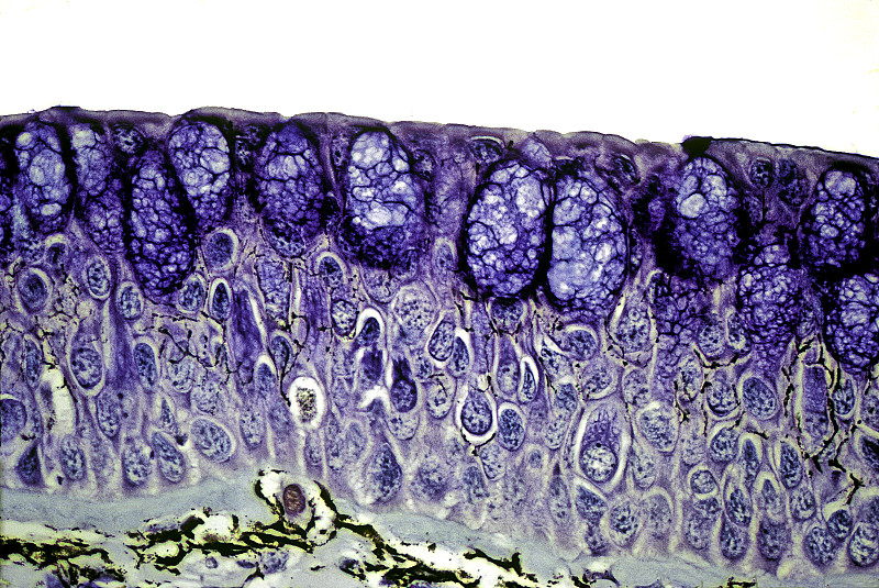 上皮细胞-肺鱼皮肤(原翼鱼属)图片素材