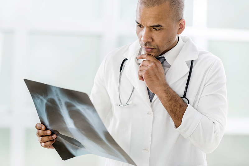 一位非裔美国医生正在看x光图像。图片下载