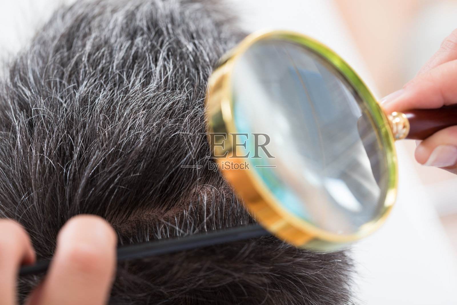 皮肤科医生检查病人的头发照片摄影图片