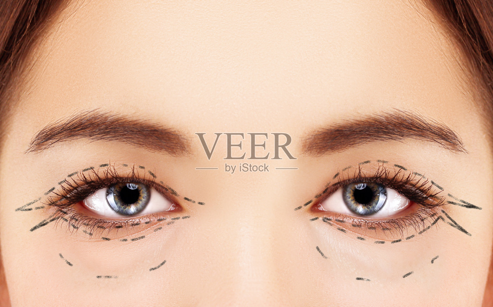 眼睑整容术。眼睑整容术。标志着脸。女性面部穿孔纹，整形外科概念。照片摄影图片