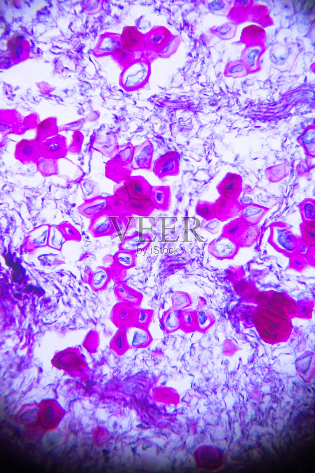 显微镜下的石梨细胞照片摄影图片