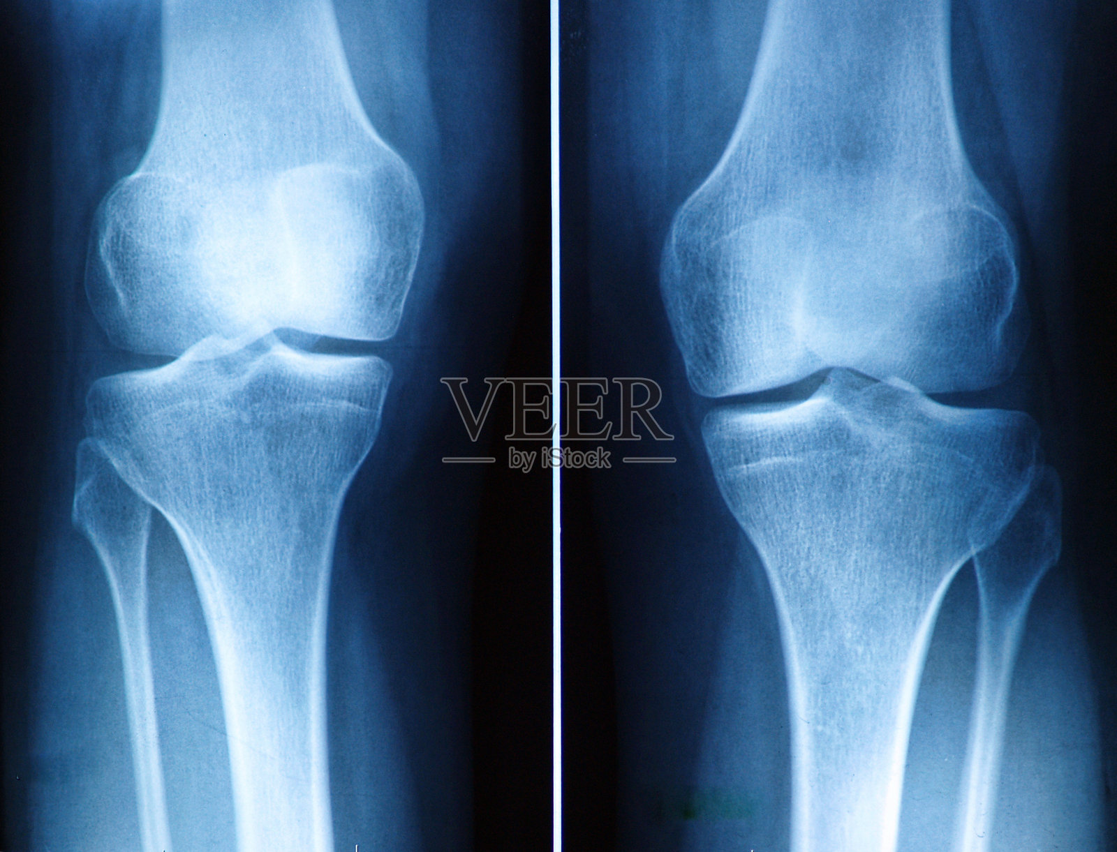 膝痹病（膝关节骨性关节炎）的居家艾灸疗法详解：配取穴图 - 知乎