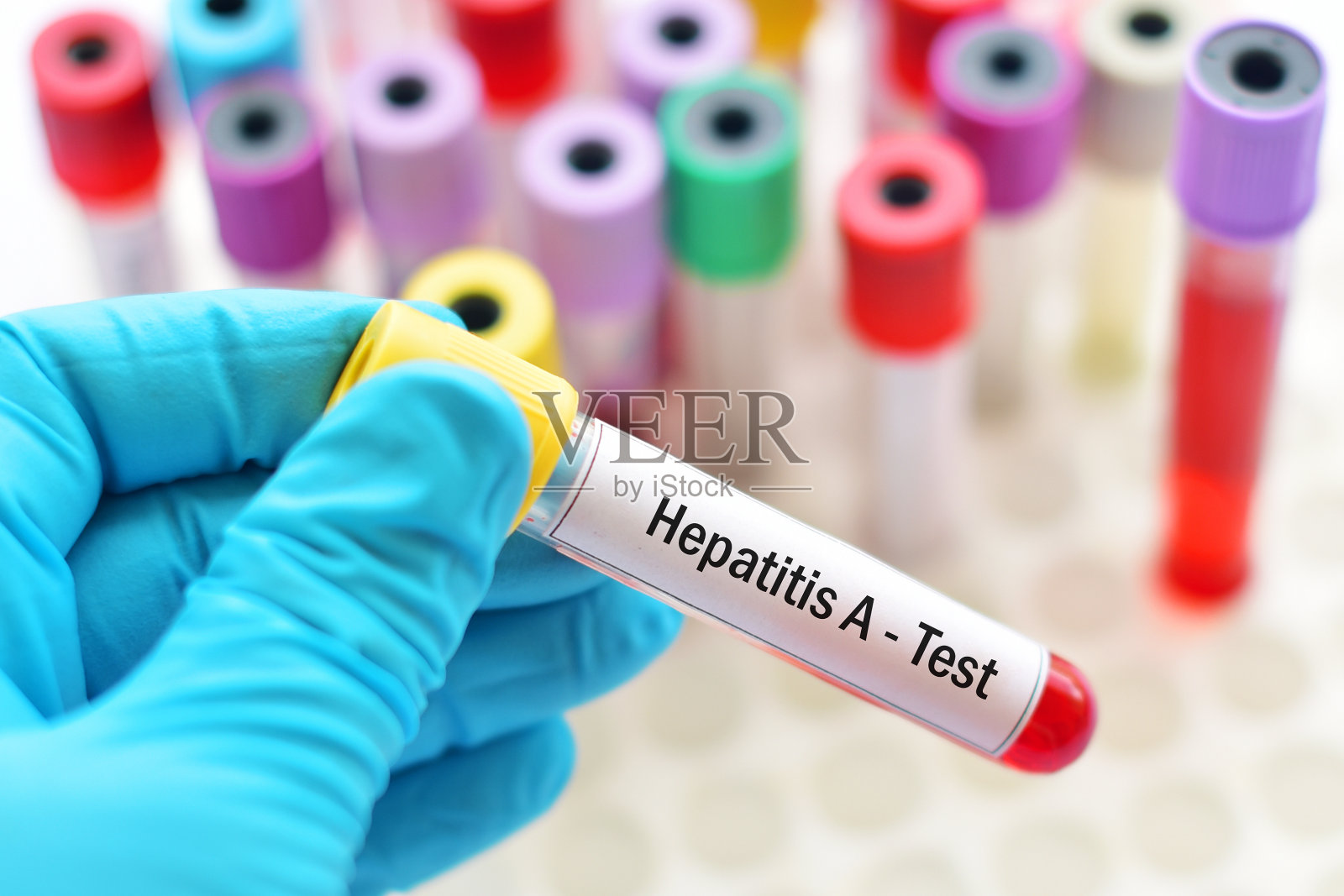 甲型肝炎病毒试验照片摄影图片
