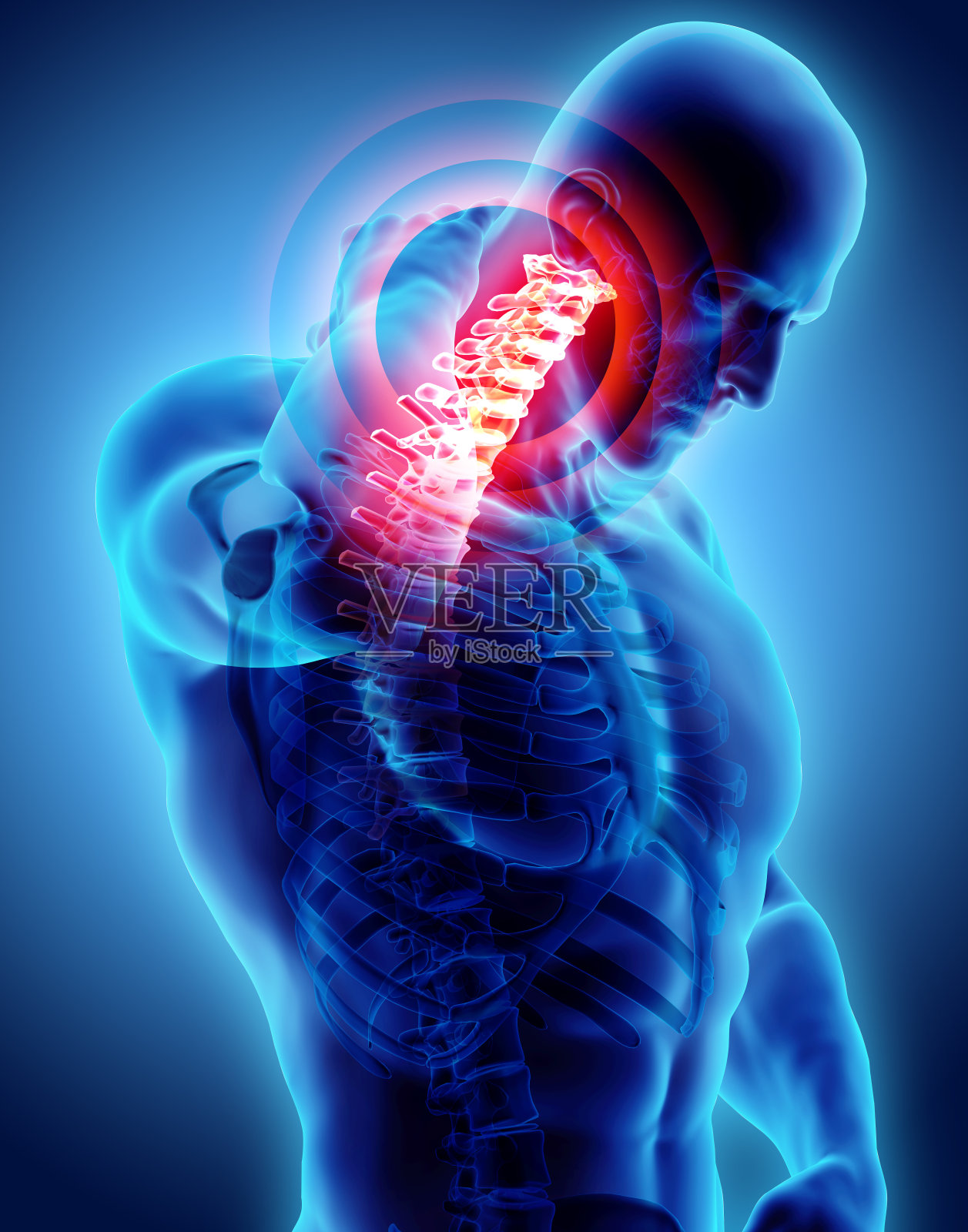 颈部疼痛-颈椎骨骼x光，3D插图。插画图片素材