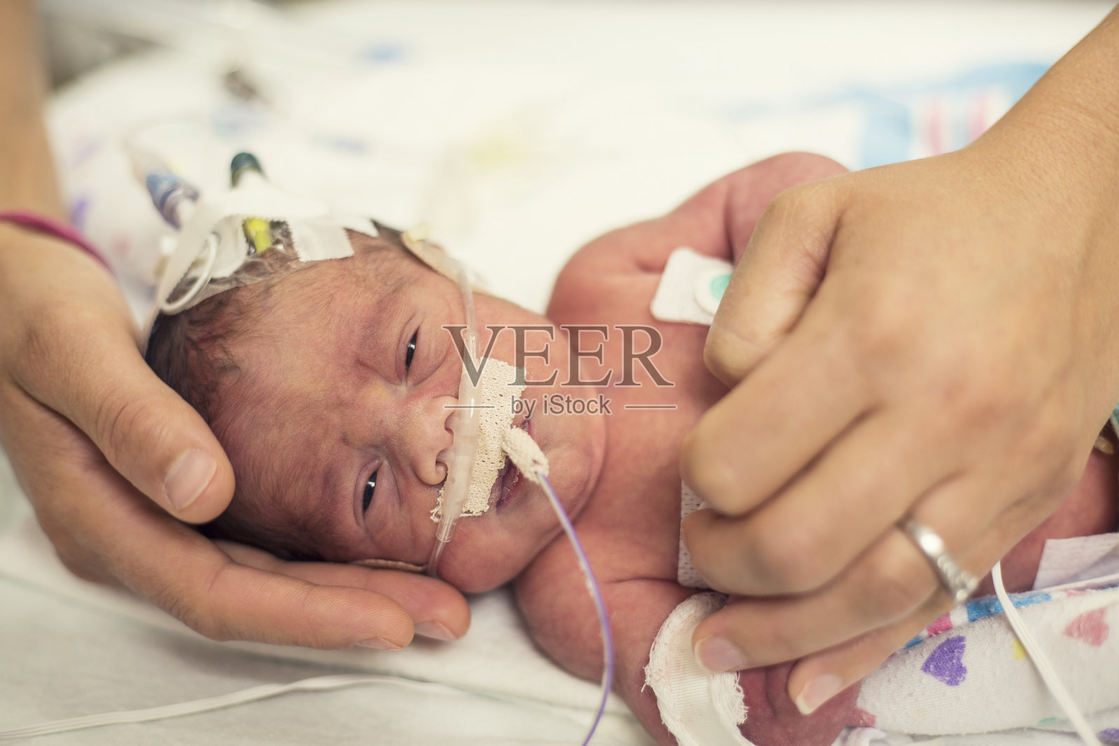 新生儿早产儿重症监护室照片摄影图片
