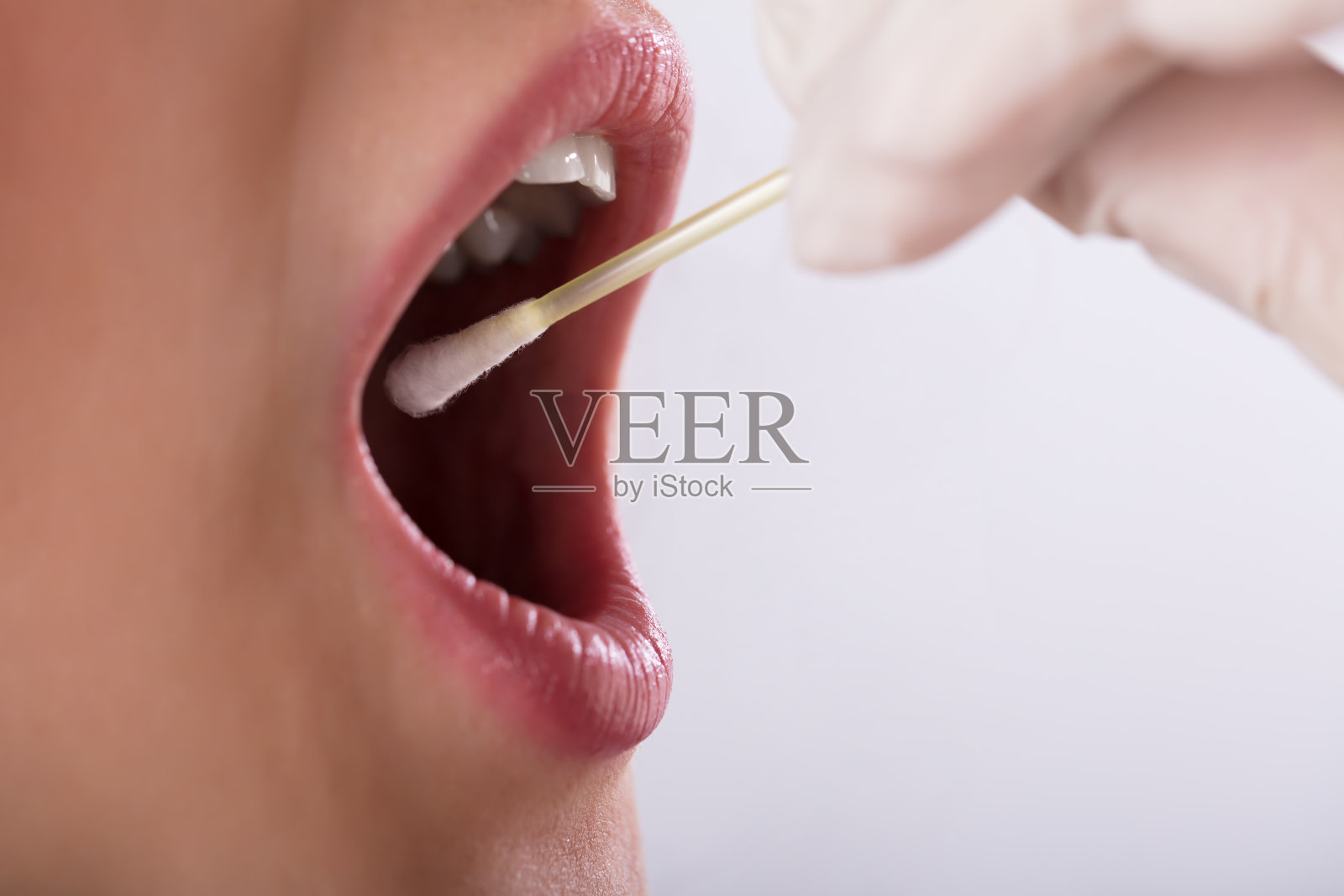牙医对病人进行唾液测试照片摄影图片