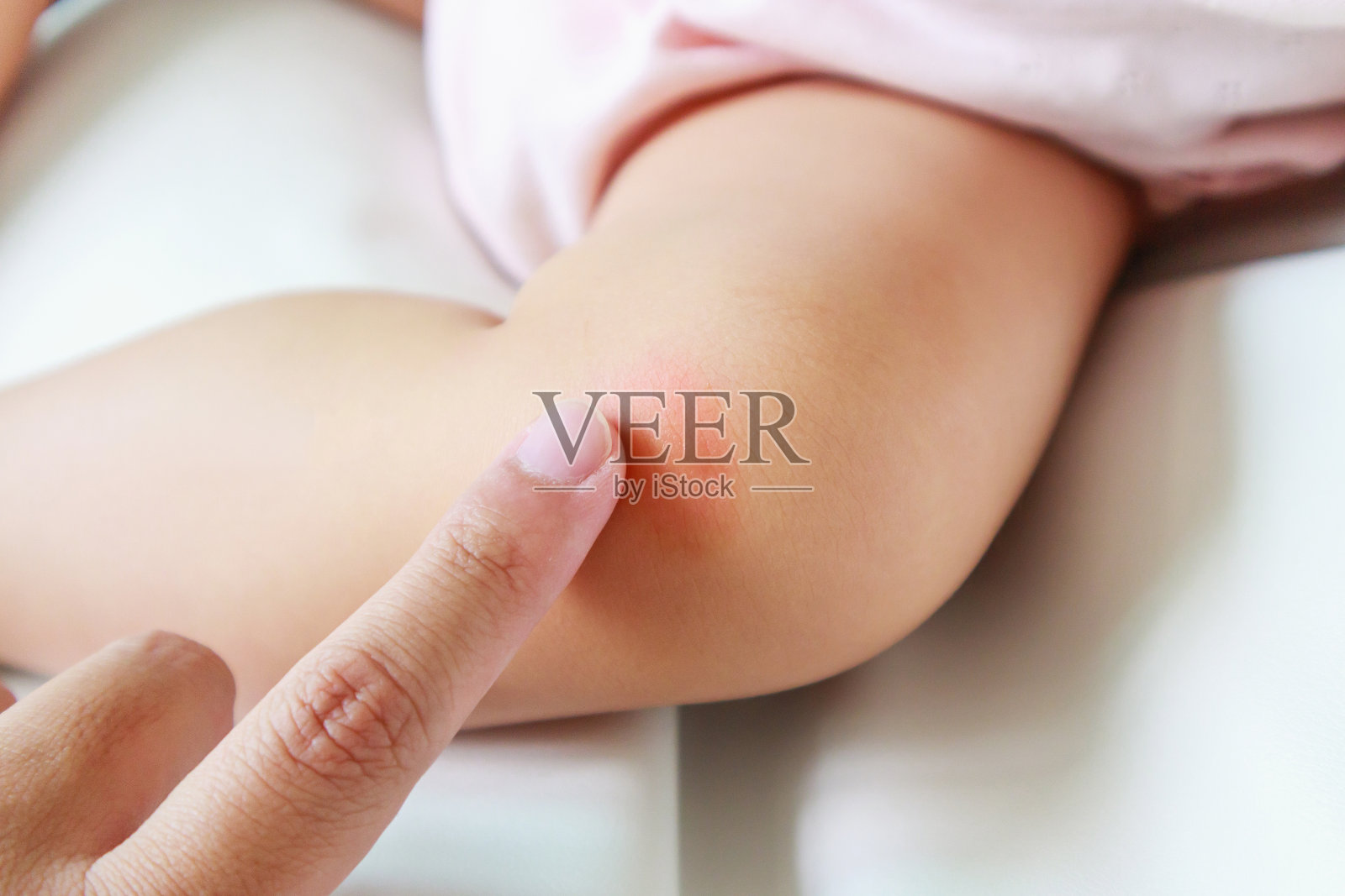 母亲用抗过敏霜涂在因蚊虫叮咬引起的宝宝膝盖上的皮疹和过敏红斑照片摄影图片