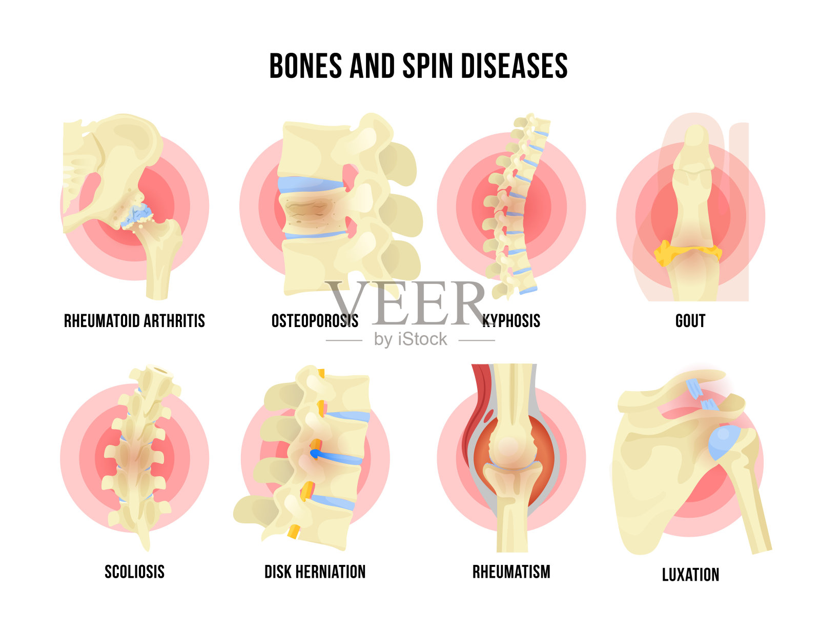 骨骼和骨骼疾病设置医学名称插画图片素材