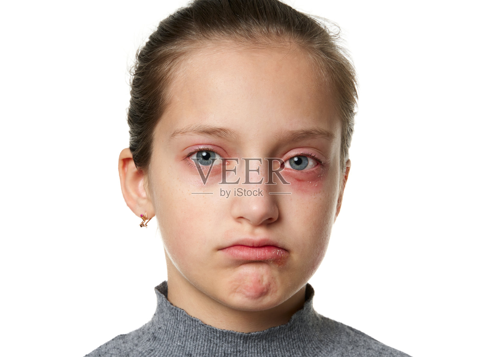 【眼痕．眼敏感】3大高危因素！ | 健康資訊 | 醫神DrApp - 24小時貼身醫生"