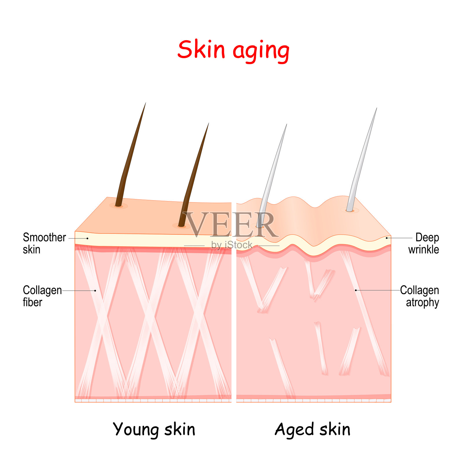 皮肤的老化过程插画图片素材