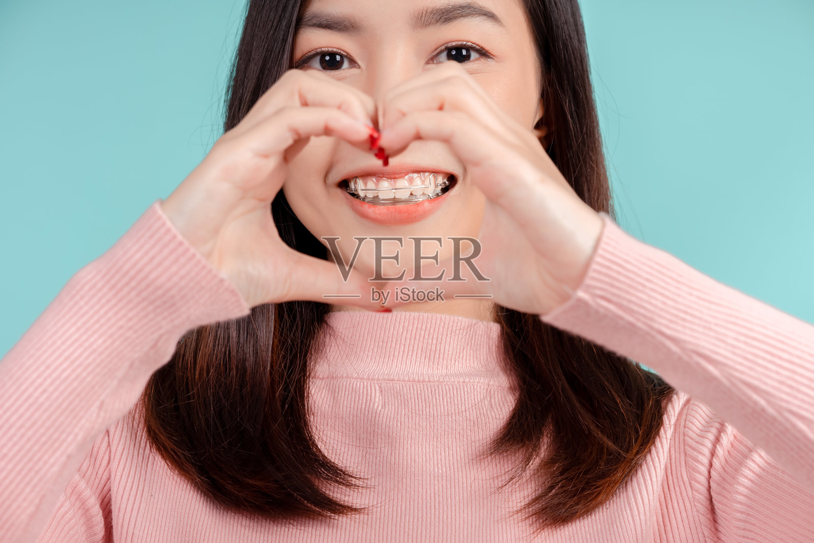 近距离情侣牙固定器的亚洲女人戴上牙套后美丽的微笑与白色的牙齿增加自信健康在蓝色背景孤立的工作室拍摄，幸福的少年微笑。照片摄影图片